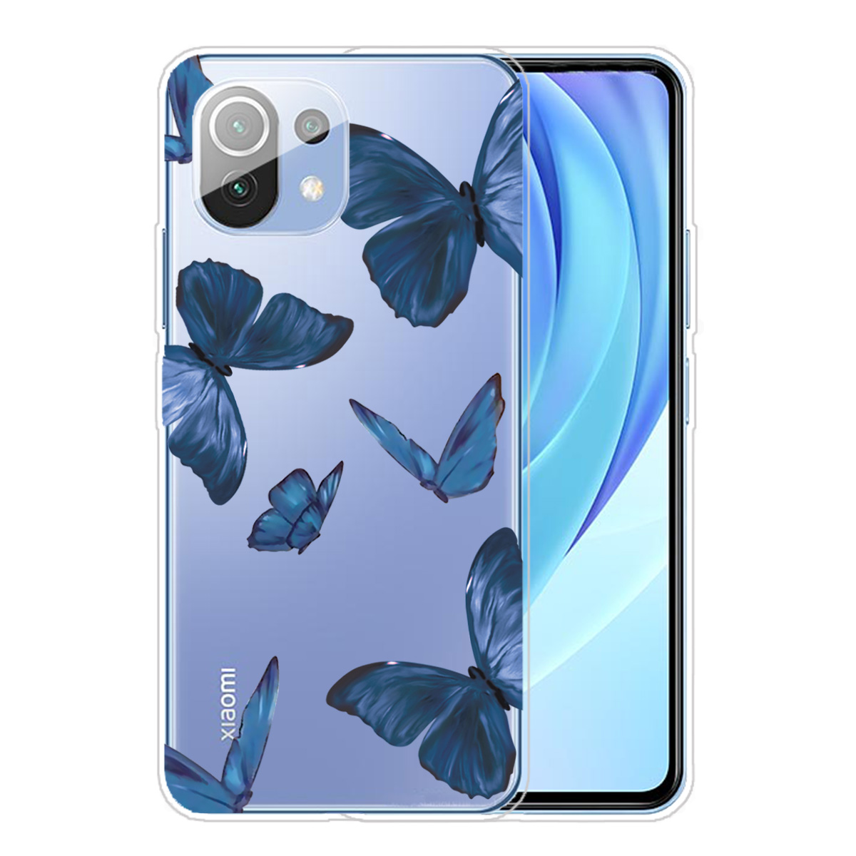 

Motif Imprimer Shell Soft Tpu Tpu Dos Case Protecteur Pour Xiaomi Mi 11 - Papillon Bleu, Xiaomi Xiaomi Mi 11