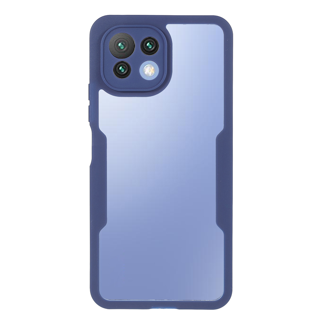 

Abnehmbar 2-in-1 Vollschutz TPU + Pet-film + Acrylhybrid-telefonkoffer Für Xiaomi Mi 11 Lite 4g / 5G /11 Lite 5G NE - Blau, Xiaomi Mi 11 Lite 5G